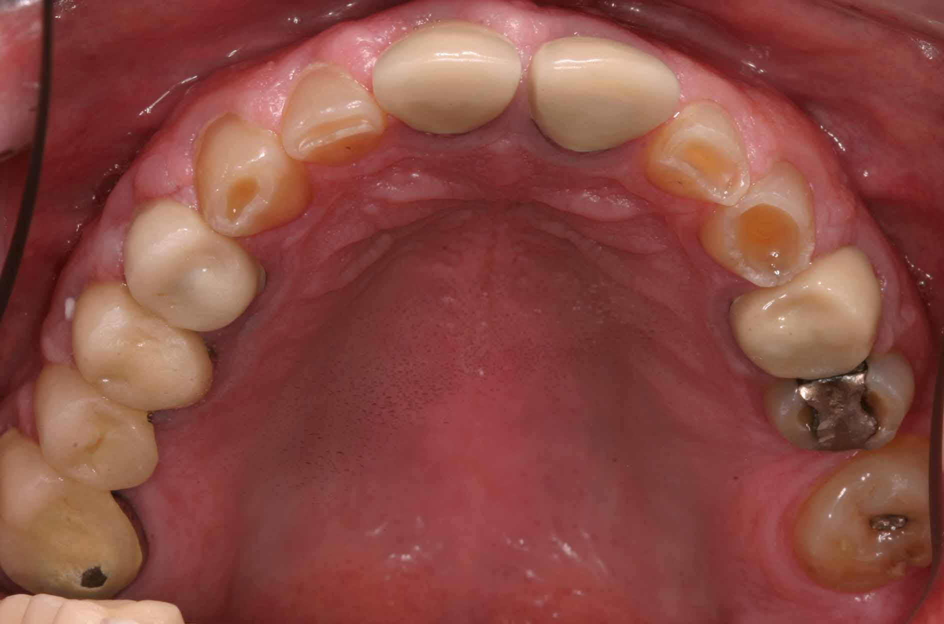 Cosmetic Dentist Fort Myers Cape Coral Naples FL